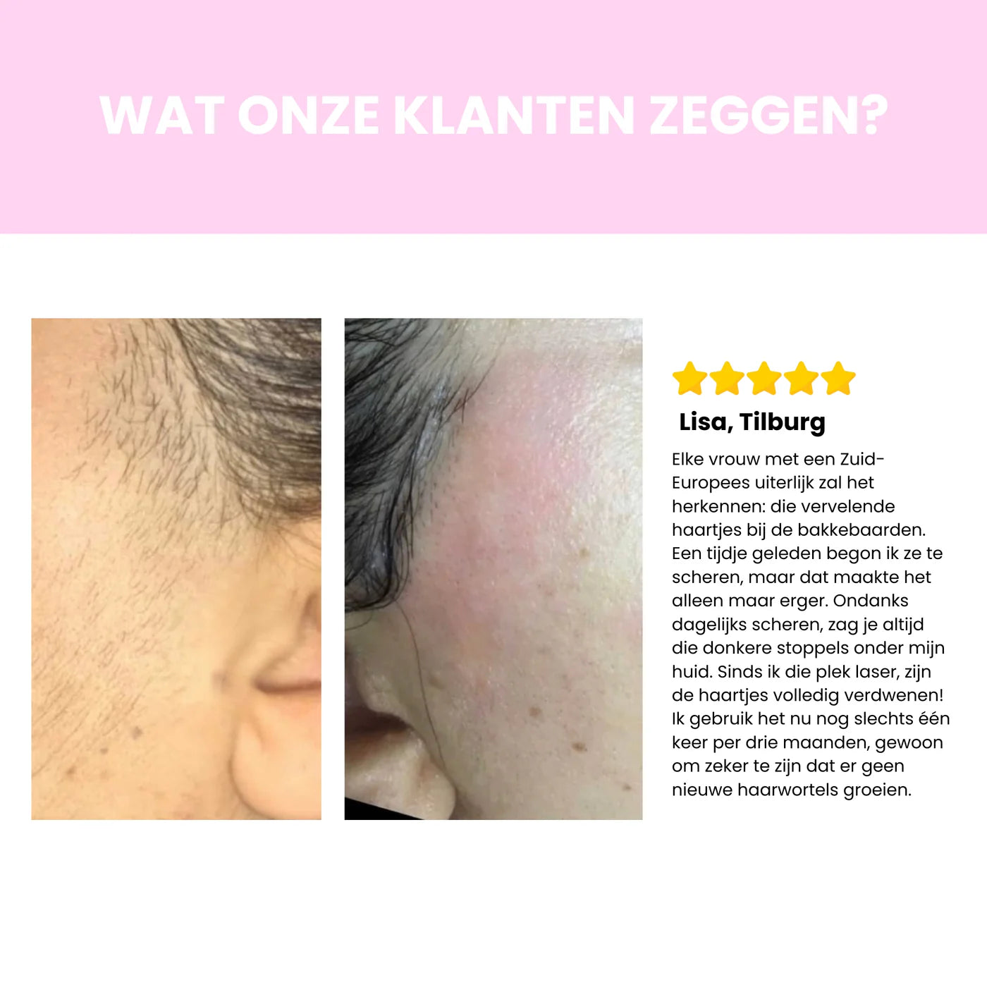 Luméra IPL Haarverwijderaar