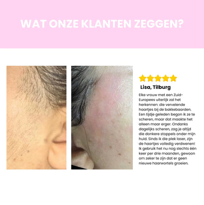 Luméra IPL Haarverwijderaar