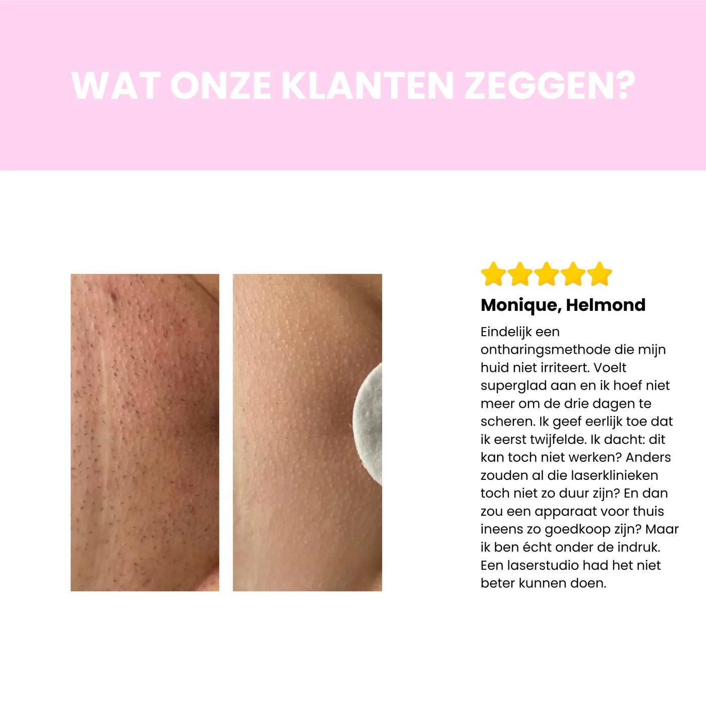 Luméra IPL Haarverwijderaar